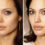 Фотошопу все звезды покорны: какие недостатки мучают артистов