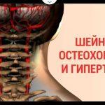 90 % ТРУДОСПОСОБНОГО НАСЕЛЕНИЯ СТРАДАЕТ ОТ ШЕЙНОГО ОСТЕОХОНДРОЗА ...ОСТАНОВИ ЭТОТ ЗАМКНУТЫЙ КРУГ !