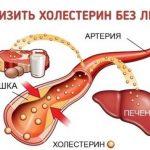 Как легко понизить уровень холестерина БЕЗ лекарств