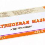 Купила в аптеке за три копейки. Я в шоке. Морщины на лбу разгладились!