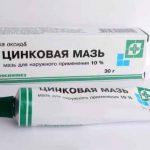 Цинковая мазь — недорогая, эффективная, просто «золотая». Применяйте вместо дорогих препаратов
