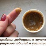 НАРОДНЫЙ РЕЦЕПТ ОТ АРТРОЗОВ И БОЛЕЙ В СУСТАВАХ