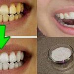 Отбеливание желтых зубов менее чем за 2 минуты!